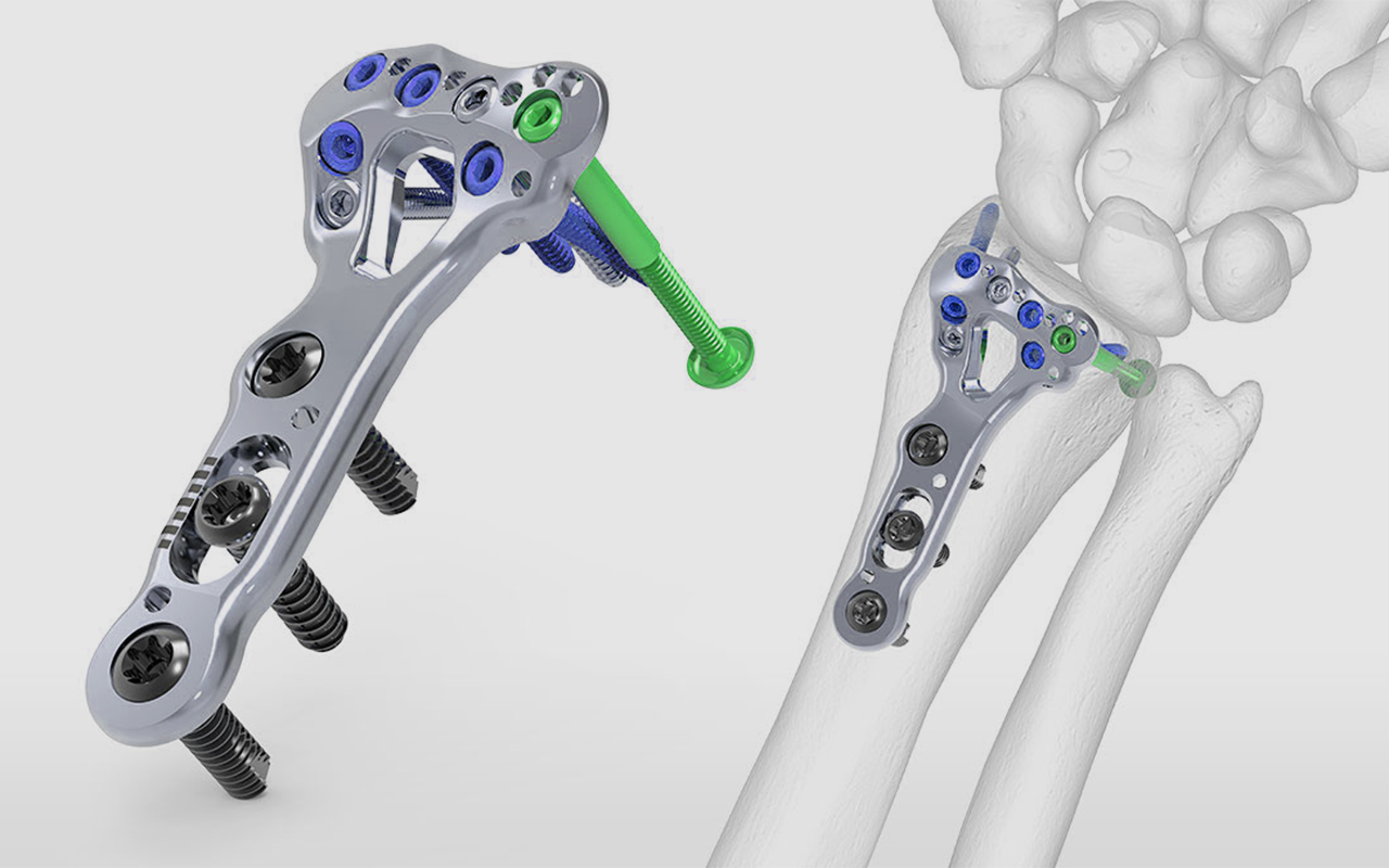 Medical Precision Parts